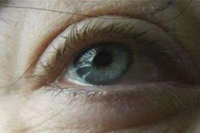 Hyaluronic Acid Eye Bag Tightening Patches